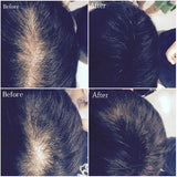 SOL &reg; Beauty Hair Building Fiber