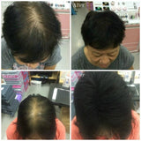 SOL &reg; Beauty Hair Building Fiber